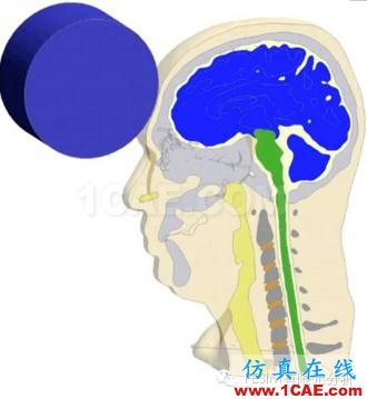 有限元分析在醫(yī)療領(lǐng)域的利用cae-fea-theory圖片2